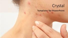  Presentation with allergy - Cool new PPT theme with itch - allergy concept young woman backdrop and a coral colored foreground