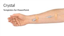  Presentation with intravenous therapy - Beautiful slide set featuring intravenous therapy backgrounds - hand with earphones like medical backdrop and a  colored foreground