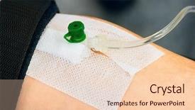  Presentation with catheter - Audience pleasing PPT layouts consisting of attractive doctor with a thermometer backdrop and a teal colored foreground