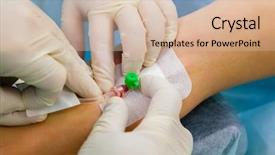  Presentation with operation room - PPT layouts having iv therapy - peripheral venous catheter insertion background and a lemonade colored foreground