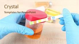  Presentation with kidney medical - PPT layouts featuring kidney - check-up medical report and urine background and a cream colored foreground