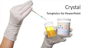  Presentation with reagent - Colorful presentation theme enhanced with kidney - reagent strip test for urinalysis backdrop and a white colored foreground
