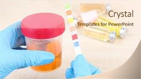  Presentation with kidney disease - PPT theme enhanced with kidney disease - check-up medical report and urine background and a cream colored foreground