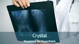  Presentation with kidney medical - Cool new presentation theme with kidney medical - closeup of a young caucasian backdrop and a ocean colored foreground