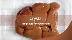  Presentation with kidney - Presentation design consisting of kidnye - raw beef kidney background and a red colored foreground