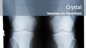  Presentation with joint - Presentation featuring knee joint x-ray film background and a ocean colored foreground