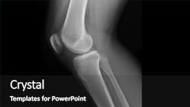  Presentation with joints - Audience pleasing presentation consisting of knee joints of an adolescent backdrop and a dark gray colored foreground