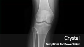  Presentation with joints - Beautiful presentation design featuring knee joints of an adolescent backdrop and a dark gray colored foreground