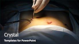  Presentation with laparoscopic surgery - PPT theme having laparoscopic surgery - doctor is pressing puncture background and a tawny brown colored foreground