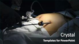  Presentation with laparoscopic surgery - Colorful theme enhanced with laparoscopic surgery - silhouette of doctor is doing backdrop and a wine colored foreground