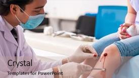  Presentation with physical therapy fracture leg - Presentation featuring leg injured young woman visiting background and a  colored foreground