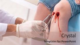  Presentation with lactation young woman breastfeeding - Slide set having leg injured young woman visiting background and a coral colored foreground