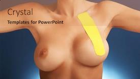  Presentation with breast - 