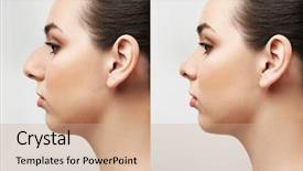  Presentation with rhinoplasty - Presentation design having light background plastic surgery background and a coral colored foreground