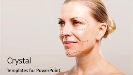  Presentation with plastic surgery - Slide set consisting of abdominal treatment - camera sonogram background and a light gray colored foreground.