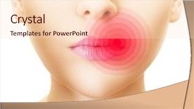  Presentation with lips - Amazing presentation design having burn patients - lips affected by herpes shown backdrop and a lemonade colored foreground