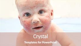  Presentation with dermatitis - Audience pleasing theme consisting of little baby with dermatitis backdrop and a coral colored foreground
