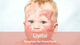  Presentation with dermatitis - Audience pleasing PPT layouts consisting of little baby with dermatitis backdrop and a coral colored foreground