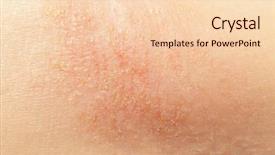  Presentation with skin - Cool new PPT layouts with little girl arm skin backdrop and a lemonade colored foreground