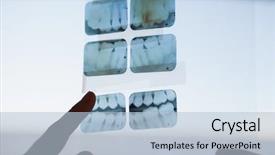  Presentation with xray - Audience pleasing presentation theme consisting of looking and pointing to xray backdrop and a light blue colored foreground