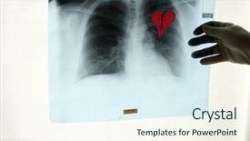  Presentation with broken heart - Beautiful slides featuring love hurts - x-ray shows a broken heart backdrop and a sky blue colored foreground