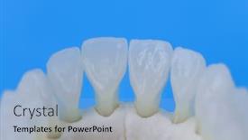  Presentation with human anatomy - Slide set featuring lower-human-jaw-with-teeth background and a light blue colored foreground