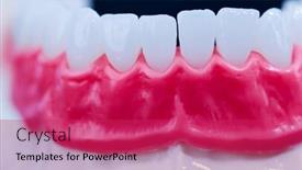  Presentation with jaw - Slide set enhanced with lower-human-jaw-with-teeth background and a red colored foreground