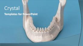  Presentation with medical concept - Presentation design consisting of lower-human-jaw-with-teeth background and a teal colored foreground