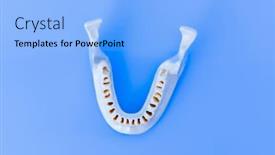  Presentation with jaw - Presentation consisting of lower-human-jaw-without-teeth background and a light blue colored foreground