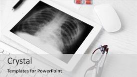  Presentation with lung - Amazing slides having lung - asthma and health care concept backdrop and a light gray colored foreground