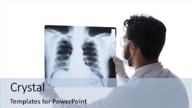  Presentation with lung - Beautiful presentation theme featuring lung - young doctor looking at x-ray backdrop and a light blue colored foreground