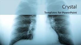  Presentation with lung disease - Slide set having lung disease - radiology classical x ray background and a light blue colored foreground