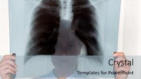  Presentation with surgical nurse - Amazing presentation theme having lung radiation - nurse or doctor in surgical backdrop and a  colored foreground