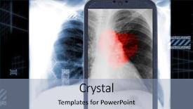  Presentation with lung heart - Presentation theme featuring lung radiation - smartphone and male chest x-ray background and a light blue colored foreground