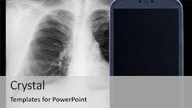  Presentation with chest - Presentation consisting of lung radiation - smatrphone and male chest x-ray background and a light gray colored foreground