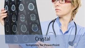  Presentation with roentgen - Cool new presentation with lung radiation - woman doctor watching roentgen records backdrop and a light blue colored foreground