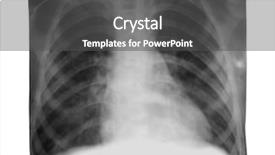  Presentation with brown sugar isolated on white - PPT theme enhanced with lung radiation - x-ray image isolated on white background and a dark gray colored foreground