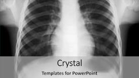  Presentation with human lung - PPT layouts enhanced with lung radiation - x-ray picture of human torax background and a light gray colored foreground