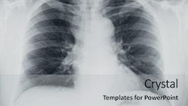 Presentation with lung - PPT theme featuring thoracic - lung x-ray background and a light gray colored foreground