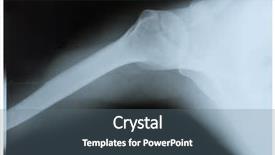  Presentation with shoulder joint - Cool new presentation with luxation - x-ray image of shoulder joint backdrop and a ocean colored foreground