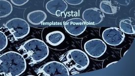  Presentation with magnetic - Audience pleasing PPT theme consisting of mutiple magnetic resonance image backdrop and a ocean colored foreground