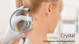  Presentation with awareness - Audience pleasing presentation theme consisting of magnifier in clinic cancer backdrop and a lemonade colored foreground