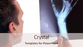  Presentation with xray - PPT theme consisting of male doctor holding up xray background and a lemonade colored foreground