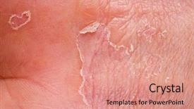  Presentation with skin - Colorful theme enhanced with male hand with skin backdrop and a coral colored foreground