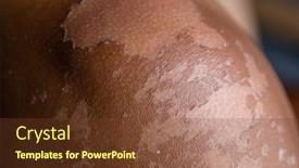  Presentation with skin - Presentation design with male-sunburned-skin-close-up background and a tawny brown colored foreground