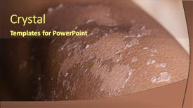 Presentation with skin - Presentation design with male-sunburned-skin-close-up background and a tawny brown colored foreground