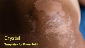  Presentation with skin - Presentation with male-sunburned-skin-close-up background and a tawny brown colored foreground