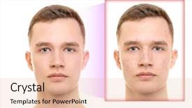  Presentation with skin care - Beautiful PPT theme featuring man before and after acne backdrop and a lemonade colored foreground