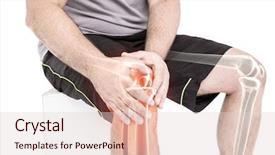  Presentation with joint pain - Beautiful presentation theme featuring man suffering with knee backdrop and a lemonade colored foreground