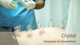  Presentation with body - Presentation with man taking cupping therapy background and a lemonade colored foreground